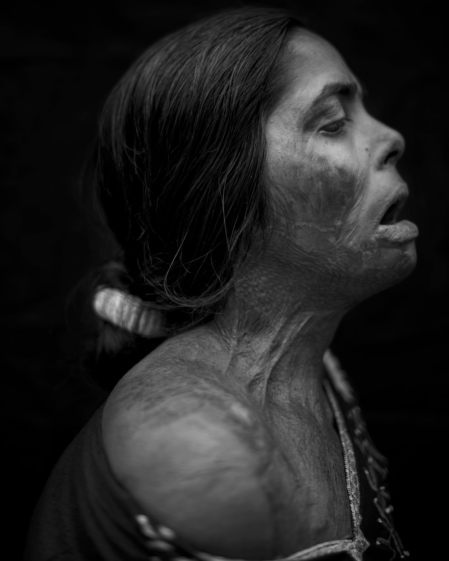 ACID VIOLENCE WOMEN
