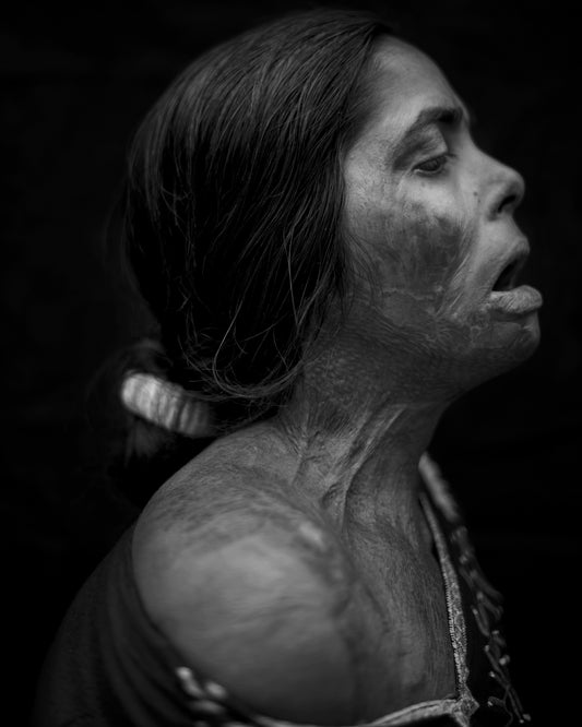 ACID VIOLENCE WOMEN
