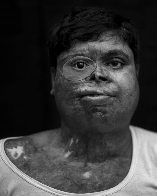 ACID VIOLENCE MAN
