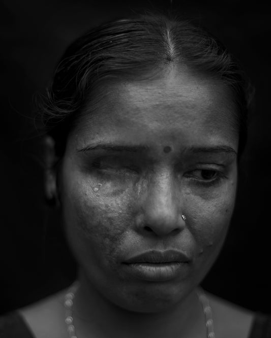 ACID VIOLENCE WOMAN WITH TEAR